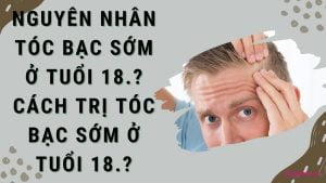 tóc bạc sớm ở tuổi 18